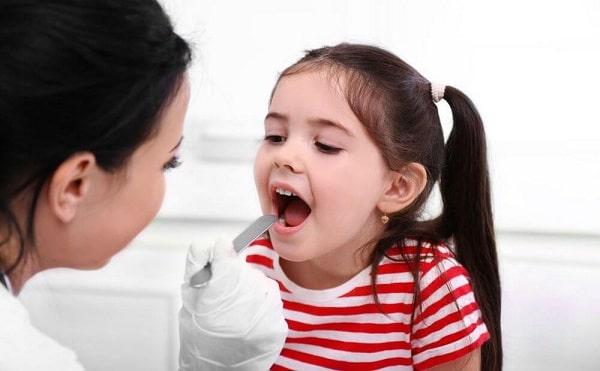 علاج فطريات الفم للاطفال